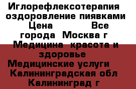 Иглорефлексотерапия, оздоровление пиявками › Цена ­ 3 000 - Все города, Москва г. Медицина, красота и здоровье » Медицинские услуги   . Калининградская обл.,Калининград г.